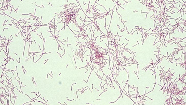 Legionella pod mikroskopem po Gramově barvení Legionelle se nejlépe daří v teplé vodě a objevuje se opakovaně
